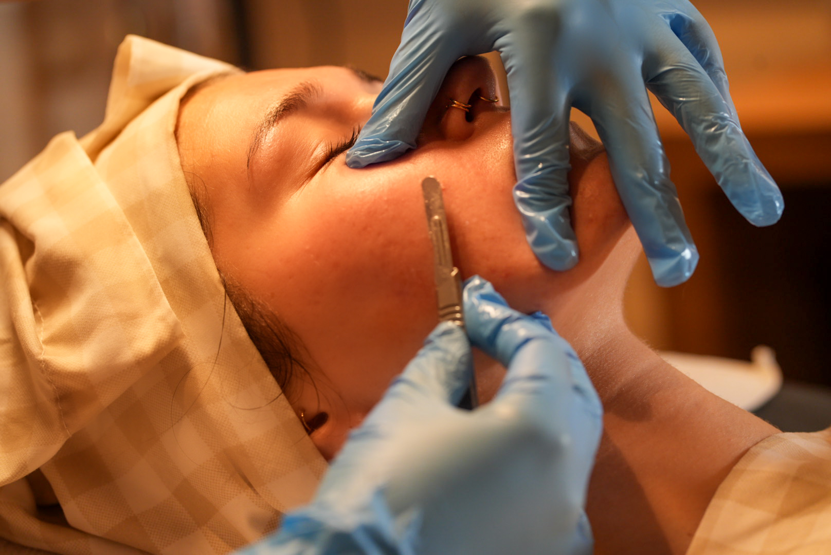 Medical professional in blue gloves administers injection to a woman's face during a cosmetic procedure.