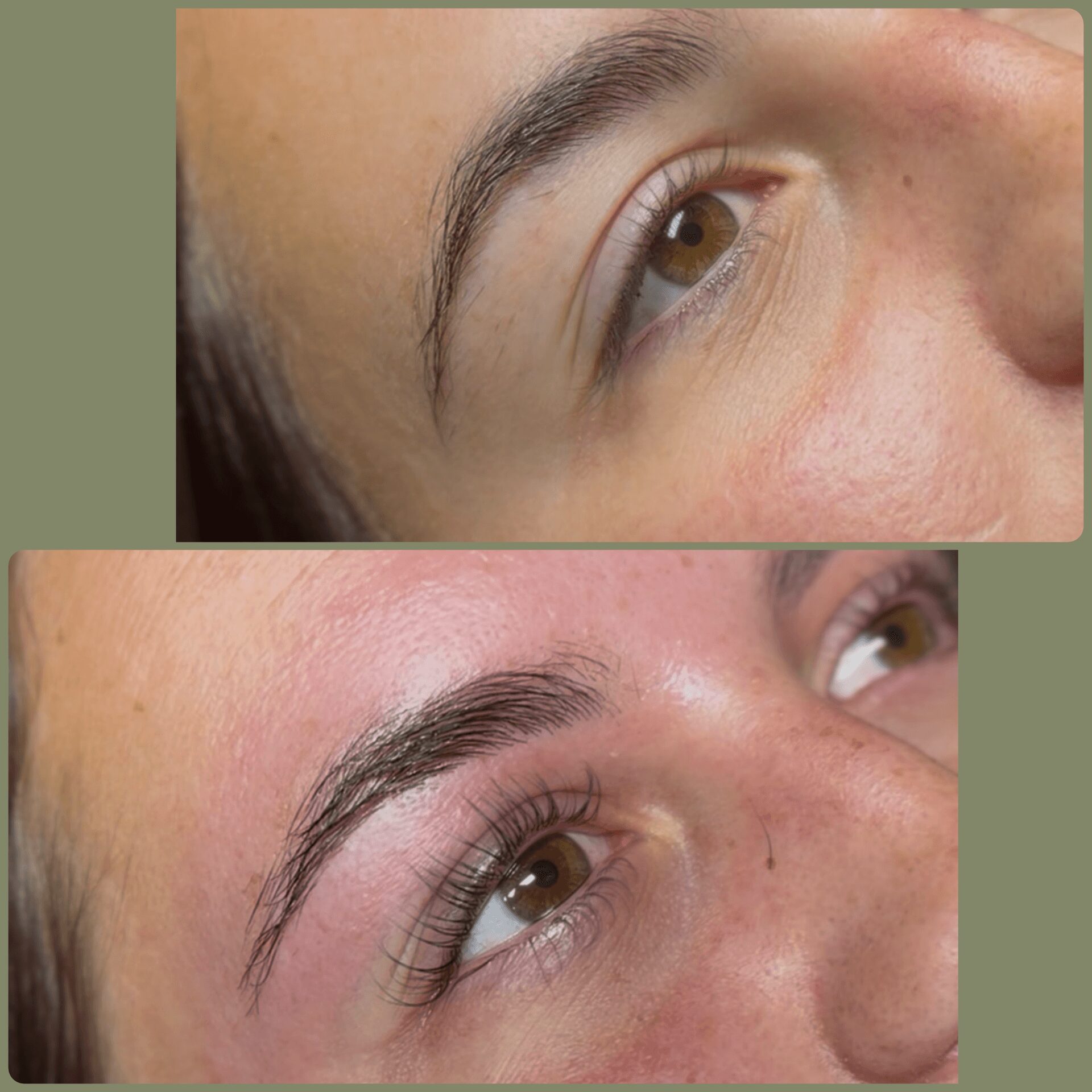 Close-up of a person's eye area before and after cosmetic treatment, showing eyebrow and eyelid changes.