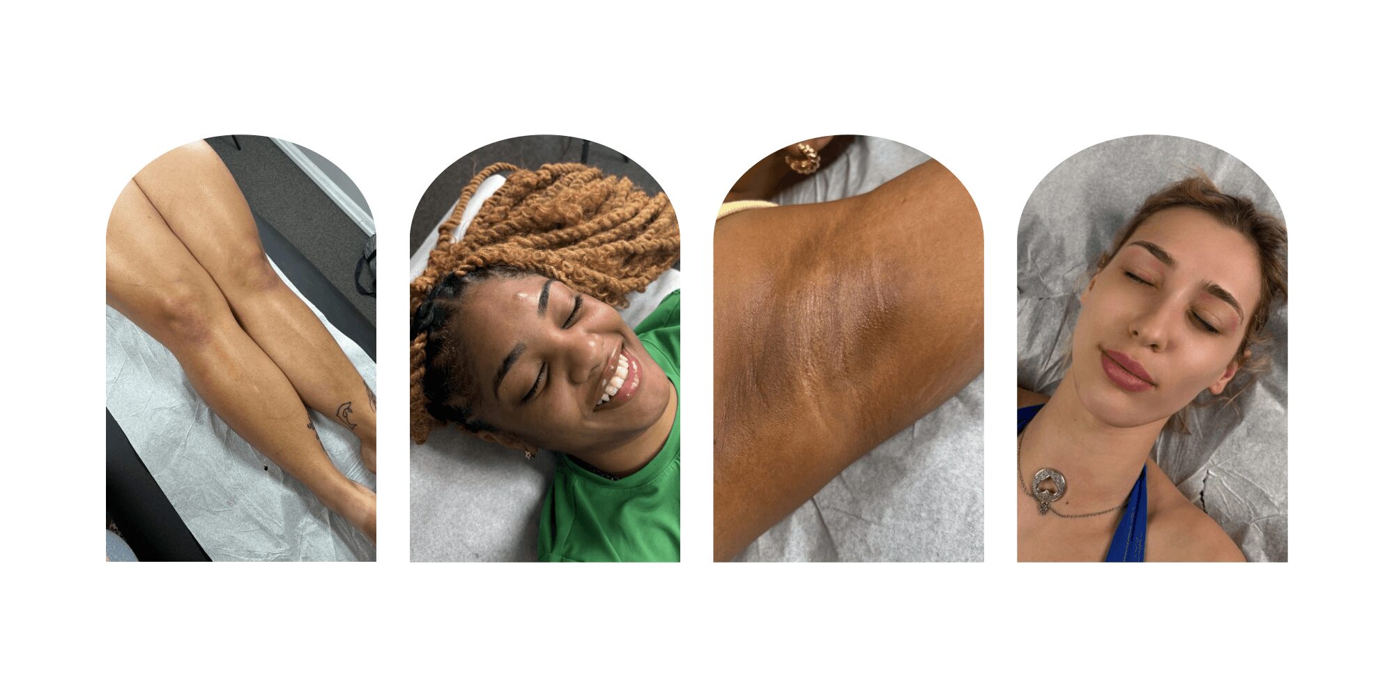 Four images showing different parts of people's bodies and faces, including legs, a smiling woman, a shoulder, and a woman resting.